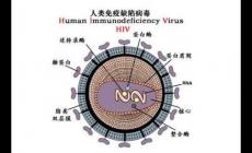 艾滋病的英文简称是aids那么hiv是什么