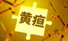 新生儿怎么看黄疸退了没有 新生儿怎么看黄疸退了没退
