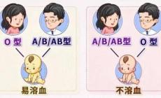 怀孕期间怎么查胎儿有没有溶血
