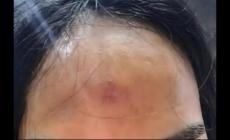 印堂发红是什么的征兆 印堂发红预示着出现哪些健康问题
